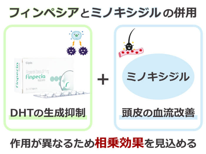 フィンペシアはミノキシジルとの併用で効果アップ