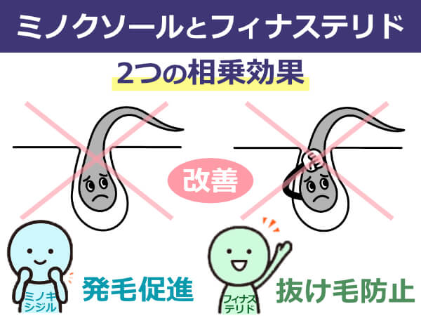 ミノクソールとフィナステリド