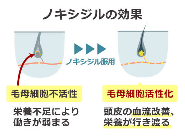 ノキシジルの効果とは？効果が実感できるまでの期間についても解説