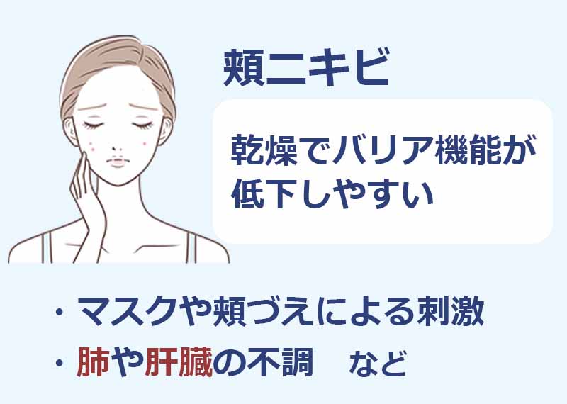 頬ニキビ,乾燥でバリア機能が低下しやすい,マスクや頬づえによる刺激,肺や肝臓の不調